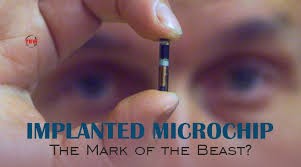 Implanted Microchip -- The Mark of the Beast